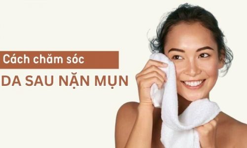 Kinh nghiệm chăm sóc da sau nặn mụn đúng cách