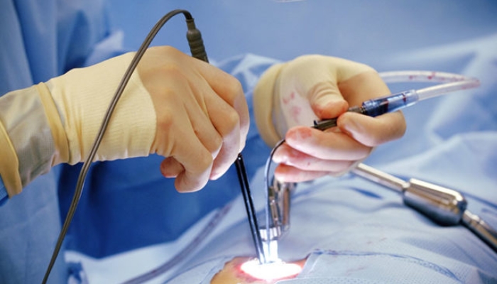 Một số loại chỉ phẫu thuật tim mạch phổ biến trên thị trường